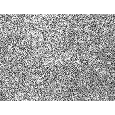 Repro MSC3 iPSC-derived MSCs
