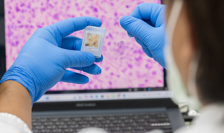 Human Tissue Samples