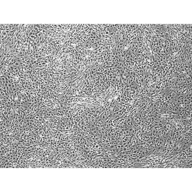 Repro MSC3 iPSC-derived MSCs